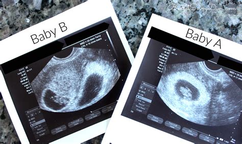 8 weeks pregnant belly pics|8 weeks pregnancy ultrasound images.